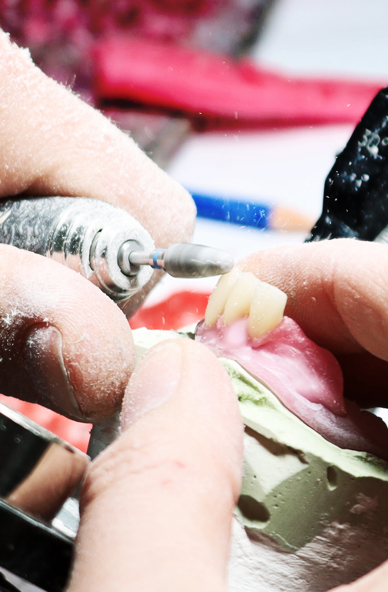 Detailarbeit am Zahnersatz